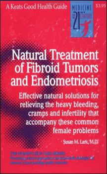 Paperback Natural Treatment of Fibroid Tumors and Endometriosis Book