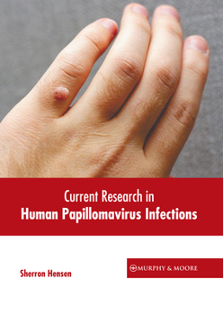Hardcover Current Research in Human Papillomavirus Infections Book