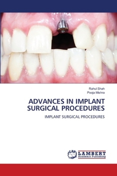 Paperback Advances in Implant Surgical Procedures Book