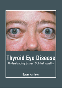Hardcover Thyroid Eye Disease: Understanding Graves' Ophthalmopathy Book