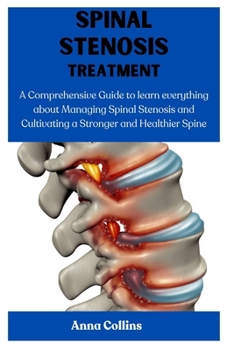 Paperback Spinal Stenosis Treatment: A Comprehensive Guide to learn everything about Managing Spinal Stenosis and Cultivating a Stronger and Healthier Spin Book