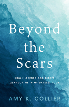 Paperback Beyond the Scars: How I Learned God Didn't Abandon Me in My Darkest Hour Book