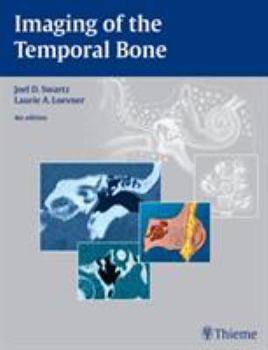 Hardcover Imaging of the Temporal Bone Book