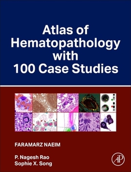 Hardcover Atlas of Hematopathology with 100 Case Studies Book
