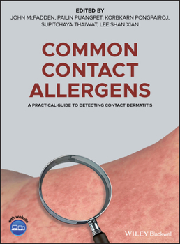 Hardcover Common Contact Allergens: A Practical Guide to Detecting Contact Dermatitis Book