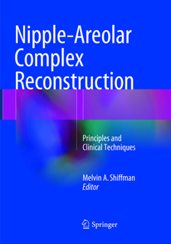 Paperback Nipple-Areolar Complex Reconstruction: Principles and Clinical Techniques Book