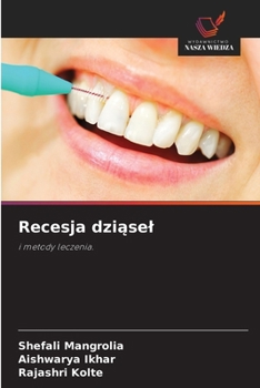 Paperback Recesja dziąsel [Polish] Book