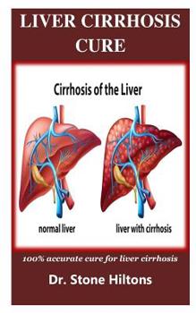 Paperback Liver Cirrhosis Cure: 100% accurate cure for liver cirrhosis Book
