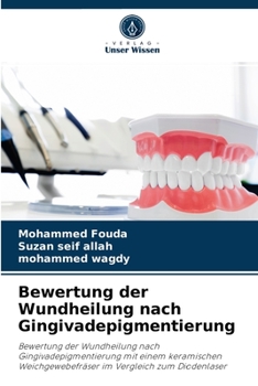 Paperback Bewertung der Wundheilung nach Gingivadepigmentierung [German] Book