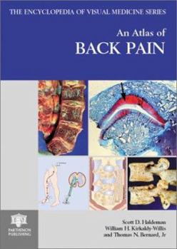 Hardcover An Atlas of Back Pain Book