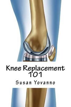 Paperback Knee Replacement 101: A User's Guide to Preparation for and Recovery After Knee Arthroplasty Book