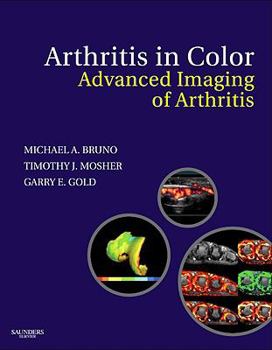 Hardcover Arthritis in Color: Advanced Imaging of Arthritis Book