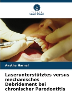 Paperback Laserunterstütztes versus mechanisches Debridement bei chronischer Parodontitis [German] Book