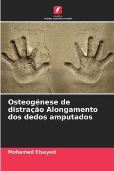 Paperback Osteogénese de distração Alongamento dos dedos amputados [Portuguese] Book
