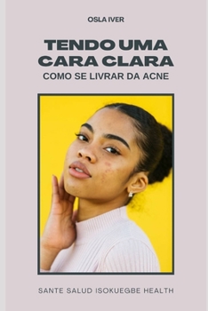 Paperback Tendo Uma Cara Clara; Como Se Livrar Da Acne: Remédio Caseiro e Dieta Para Acne [Portuguese] Book