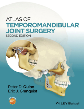 Hardcover Atlas of Temporomandibular Joint Surgery Book