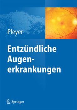 Hardcover Entz?ndliche Augenerkrankungen [German] Book