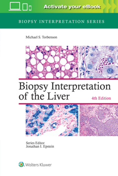 Hardcover Biopsy Interpretation of the Liver Book