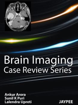 Brain Imaging: Case Review Series
