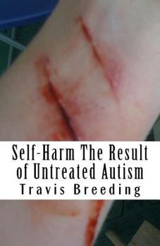 Paperback Self-Harm The Result of Untreated Autism Book