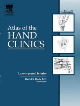 Hardcover Rheumatoid Arthritis of the Wrist, an Issue of Atlas of the Hand Clinics: Volume 10-2 Book