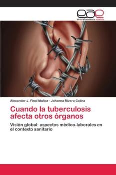 Paperback Cuando la tuberculosis afecta otros órganos [Spanish] Book