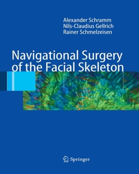 Paperback Navigational Surgery of the Facial Skeleton Book