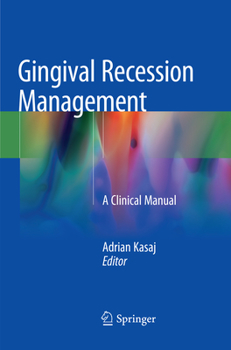 Paperback Gingival Recession Management: A Clinical Manual Book