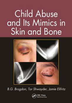 Paperback Child Abuse and Its Mimics in Skin and Bone Book