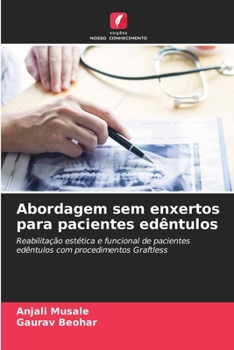 Paperback Abordagem sem enxertos para pacientes edêntulos [Portuguese] Book
