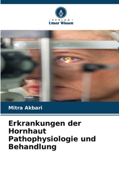 Paperback Erkrankungen der Hornhaut Pathophysiologie und Behandlung [German] Book