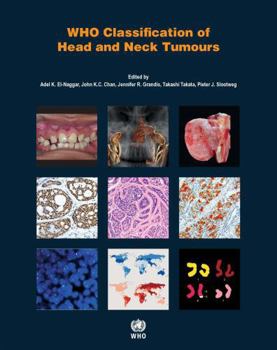 Paperback WHO Classification of Head and Neck Tumours Book