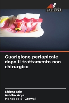 Paperback Guarigione periapicale dopo il trattamento non chirurgico [Italian] Book