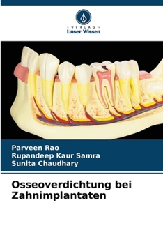 Osseoverdichtung bei Zahnimplantaten (German Edition)