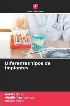 Diferentes tipos de implantes (Portuguese Edition)