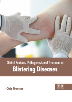 Hardcover Clinical Features, Pathogenesis and Treatment of Blistering Diseases Book