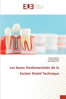 Les bases fondamentales de la Socket Shield Technique