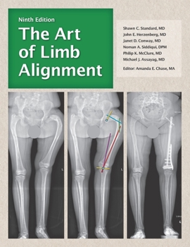 Paperback The Art of Limb Alignment, Ninth Edition Book