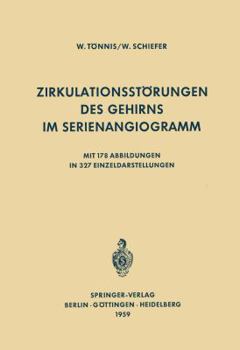 Paperback Zirkulationsstörungen Des Gehirns Im Serienangiogramm [German] Book