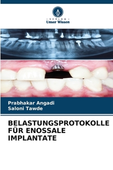 Paperback Belastungsprotokolle Für Enossale Implantate [German] Book