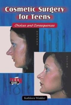 Library Binding Cosmetic Surgery for Teens: Choices and Consequences Book