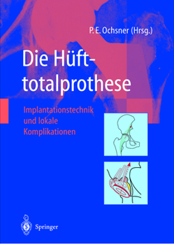 Paperback Die Hüfttotalprothese: Implantationstechnik Und Lokale Komplikationen [German] Book