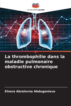 Paperback La thrombophilie dans la maladie pulmonaire obstructive chronique [French] Book