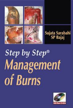 Paperback Step by Step Management of Burns Book