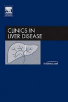 Hardcover Alcoholic Liver Disease, an Issue of Clinics in Liver Disease: Volume 9-1 Book