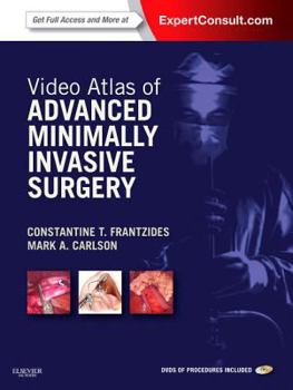 Hardcover Video Atlas of Advanced Minimally Invasive Surgery: Expert Consult - Online and Print Book