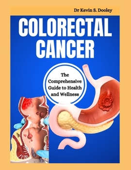 Colorectal Cancer: The Comprehensive Guide to Health and Wellness