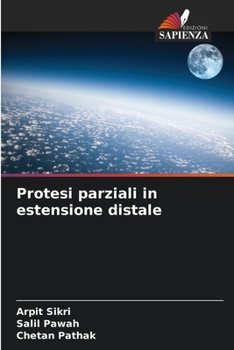 Paperback Protesi parziali in estensione distale [Italian] Book