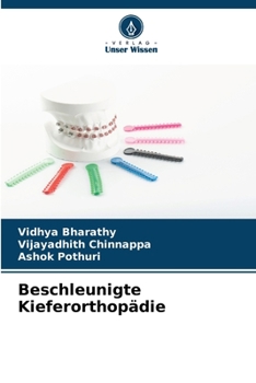 Paperback Beschleunigte Kieferorthopädie [German] Book