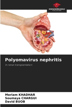Paperback Polyomavirus nephritis Book
